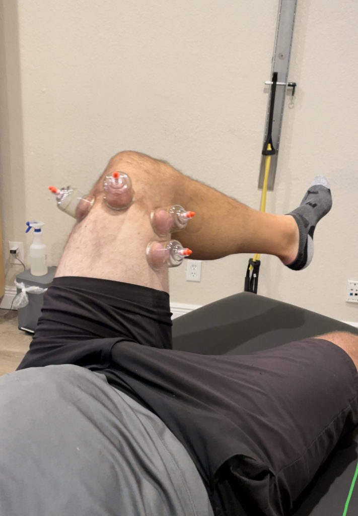 Muscle Recovery. Recovery Services that help with myofascial release using IASTM tools, fascial stretch therapy, weight training, strength training, and other services in Lake Worth, and Wellington FL.